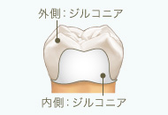 フルジルコニア