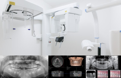 歯科用3D(立体)CT