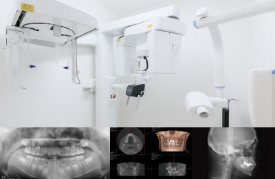 歯科用3D（立体）CT